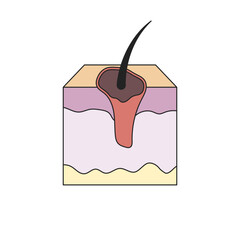 skin cancer illustration