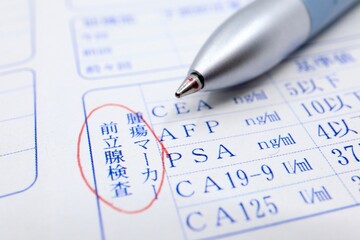 前立腺検査。腫瘍マーカー。前立腺がんの検査。