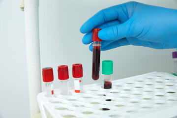 Scientist working with blood sample in laboratory