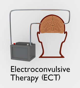 Electroconvulsive Therapy concept
