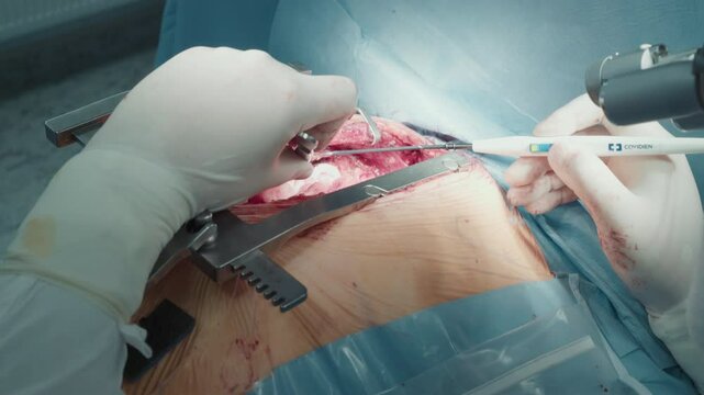 Surgeon performs laser procedure in clinic. Skilled doctor maneuvers laser tools with precision during delicate heart operation in well-lit clinic