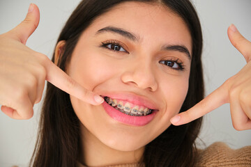 Latin female teenager smiling and pointing at her dental braces.