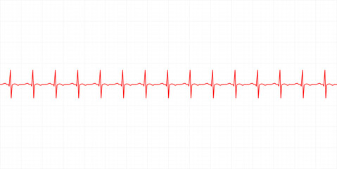 Electrocardiography heartbeat line monitor. Ecg
