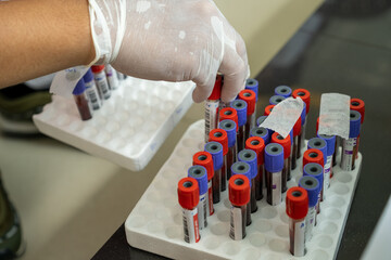 a medical worker wearing blue latex gloves is moving a vacutainer or blood sample collection tube in a styrofoam dry box in a laboratory or hospital