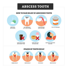 Abscess Tooth infographic medical poster education, labeled relief pain and stages of tooth decay, enamel decay, dentin decay, pulp decay and infected. Gingivitis disease, gum teeth treatment.
