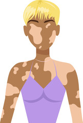 Fototapeta premium Lovely woman with vitiligo. Concepts of body positivity in people suffering from dermatological illness or vitiligo syndrome. Support people with chronic skin disorder. Vector illustration 