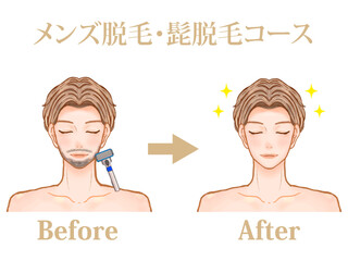 メンズエステでメンズ脱毛をした大人男性のビフォーアフターのイラスト素材