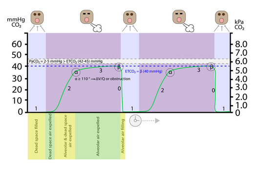 Capnography Waveform Detailed Infographic