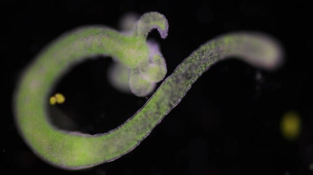Hydra is a genus of small, fresh-water animals of the phylum Cnidaria and class Hydrozoa under the microscope for education.