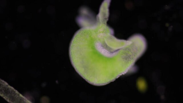 Hydra is a genus of small, fresh-water animals of the phylum Cnidaria and class Hydrozoa under the microscope for education.