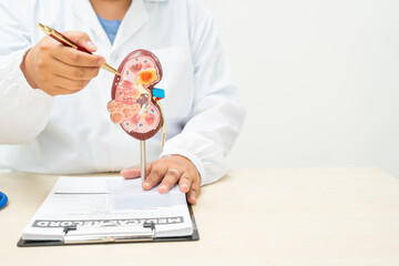  A female doctor works at a desk in a hospital, discussing kidney failure and chronic kidney...