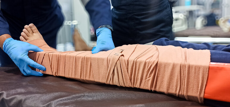 splinting a leg bitten by a snake