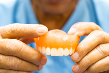 Asian elderly woman patient holding to use denture, healthy strong medical.