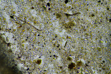 Soil under the microscopy, looking at sand, silt and clay and soil biology, amoebae, fungi, fungal, microbes and nematodes in a cattle farm in australia. 
