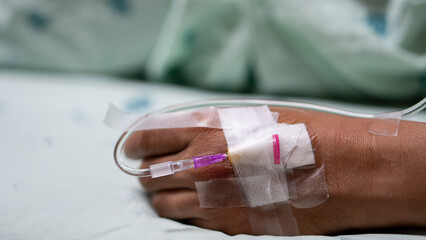Close-up of patient hand with IV catheter securely taped to skin in hospital, indicating a medical treatment or procedure.