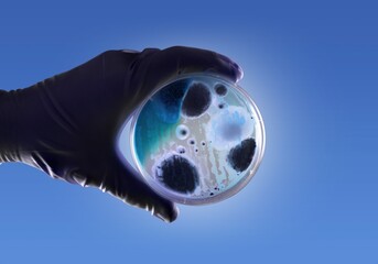 Mold petri dish in doctor hands © BillionPhotos.com