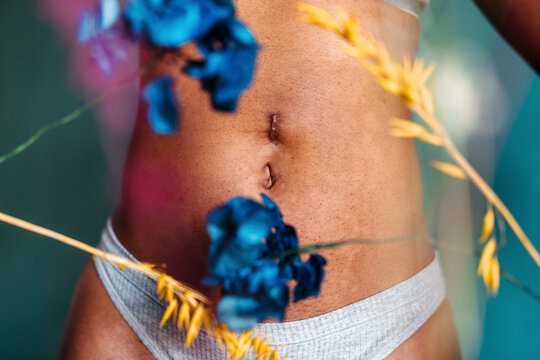 Woman's abdomen with hernia scar on belly