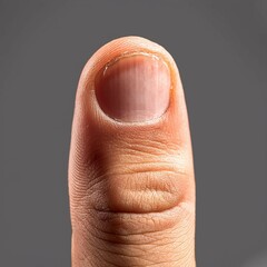 Macro photo of a woman's hand, showcasing the delicate skin and nails, and the contrast between health and injury