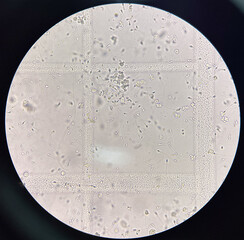 Sperm finding with light microscope 400x