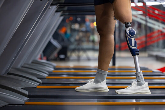 Close up of prosthetic leg from amputation doing walking workout exercise using treadmill at gym for healthy and recovery in handicap and disability people - Powered by Adobe