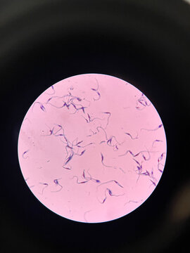 Trypanosoma cruzi desde un microscopio