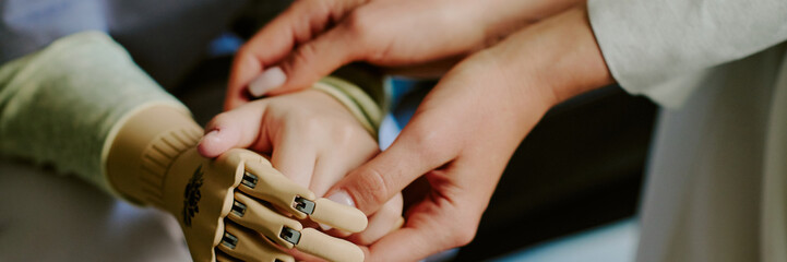 Gently holding prosthetic hand creating connection between human touch and assistive technology....