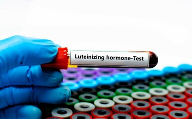 Blood sample tube for luteinizing hormone test analysis.