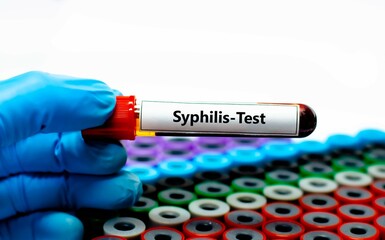 Blood sample tube for syphilis test analysis.
