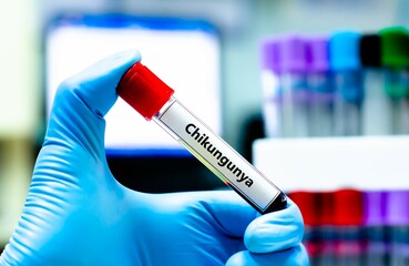 Naklejka premium Blood sample tube for chikungunya test analysis.