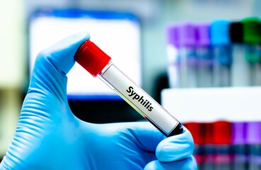 Blood sample tube for syphilis test analysis.