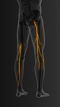 Sciatic nerve pain travelling to toes