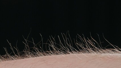 Macro shot of Hair Standing on End Against a Dark Background
