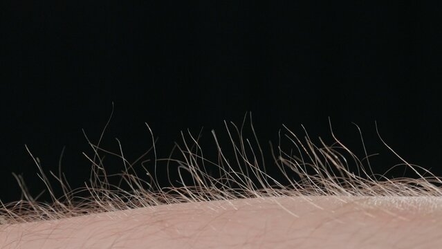 Macro shot of Hair Standing on End Against a Dark Background