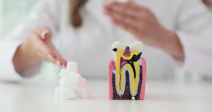 Dentist draws attention to tooth model and sugar cubes on table. Female dentist highlights correlation between excessive sugar intake and cavity formation