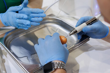 Sinus lifting using an erbium laser on a raw chicken egg. The dentist conducts training.