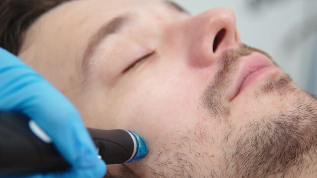 Cosmetology clinic. Professional female cosmetologist doing hydrafacial procedure while working. Attractive man lying on medical bed during cosmetic procedures