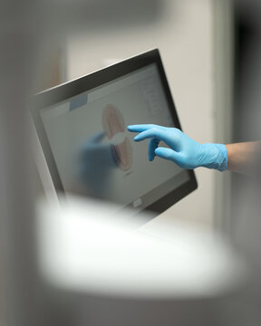 3D scanning of oral cavity. dentist's hand in blue glove touches display of intraoral scanner. 3D model of patient's jaw on monitor. Creation of digital impressions of teeth by dentist.
