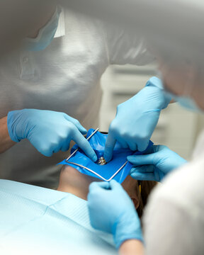 Dentists install rubber dam in oral cavity. Tooth isolation using rubber dam. Dental assistants prepare patient for dental treatment process. Preparing oral cavity assistants for dental work