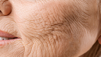 Naklejka premium Skin wrinkles and signs of aging, featuring details of facial wrinkles, fine lines, and texture variations, symbolizing aging, skincare, and beauty.