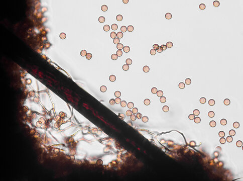 Spores, sporangia, mycelium, hypha of Stemonitis Splendens slime mold grown on rotting wood. Seen in optical microscope with 40x objective