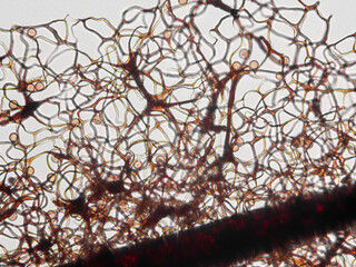 Spores, sporangia, mycelium, hypha of Stemonitis Splendens slime mold grown on rotting wood. Seen...