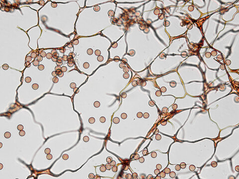 Spores, sporangia, mycelium, hypha of Stemonitis Splendens slime mold grown on rotting wood. Seen in optical microscope with 40x objective