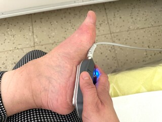 Medical procedure ultrasound of the heel Close-up ultrasound of the leg