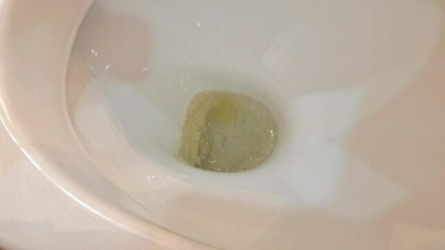 A faint stream of urine trickles down the toilet. Concept of urinary diseases, difficulty urinating, prostate problems.