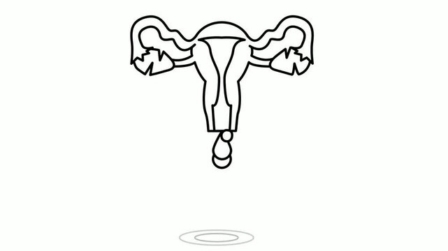 Abnormal Uterine Bleeding animation, Extremely heavy period or flow animated video, In Vitro Fertilization Clip, Pregnancy and obstetrician footage, test tube baby procedure motion graphics