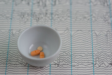 Antiepileptic drugs on EEG graph