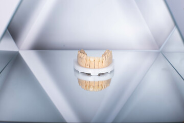 Glass ceramic dental porcelain veneers and crowns used in smile design treatment in dental dentistry.  © Nastasia