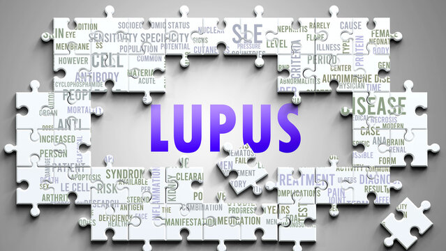Lupus as a complex subject, related to important topics. Pictured as a puzzle and a word cloud made of most important ideas and phrases related to lupus. ,3d illustration