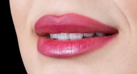 Fototapeta premium ceramic veneers b1 color