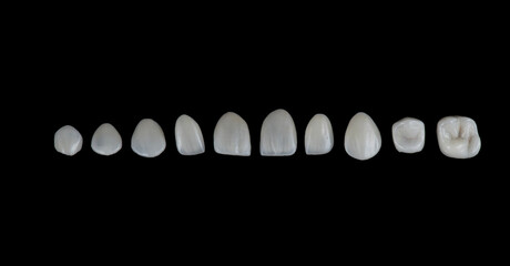 ceramic veneers b1 color